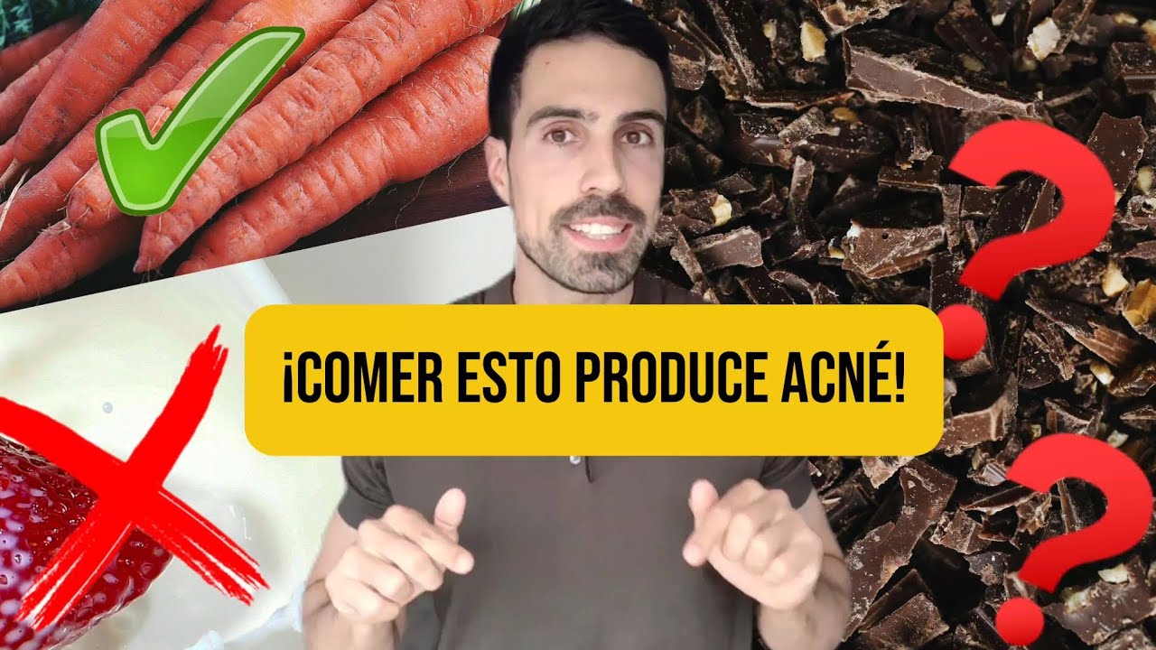 dieta para eliminar el acné en 3 días