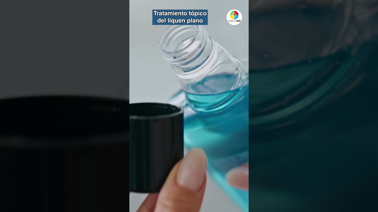 natrum muriaticum para el liquen plano