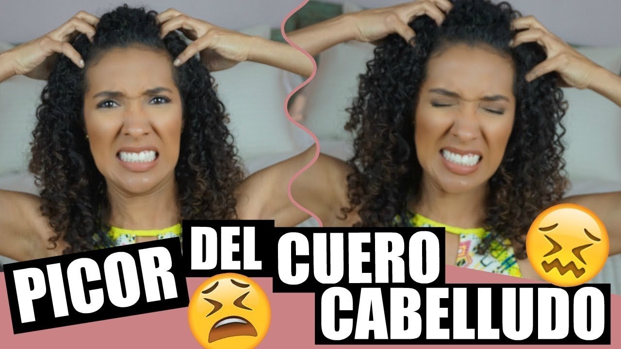 picor en el cuero cabelludo remedios caseros