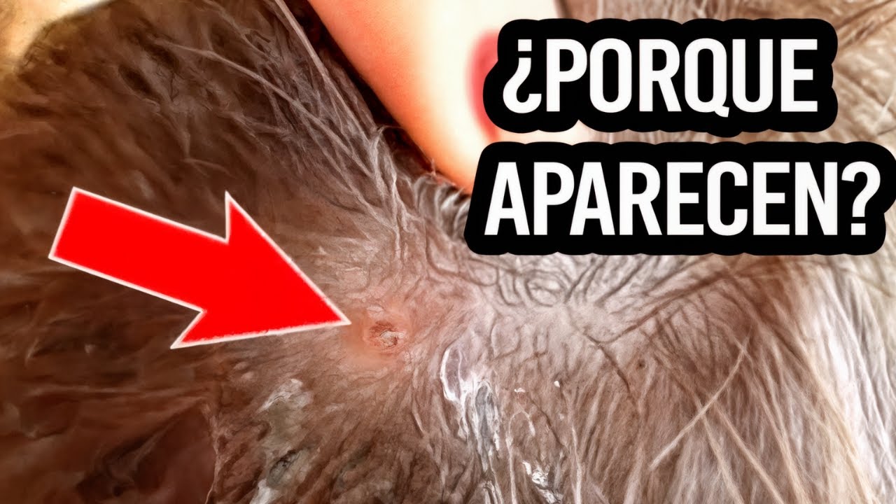 pq salen granos en la cabeza