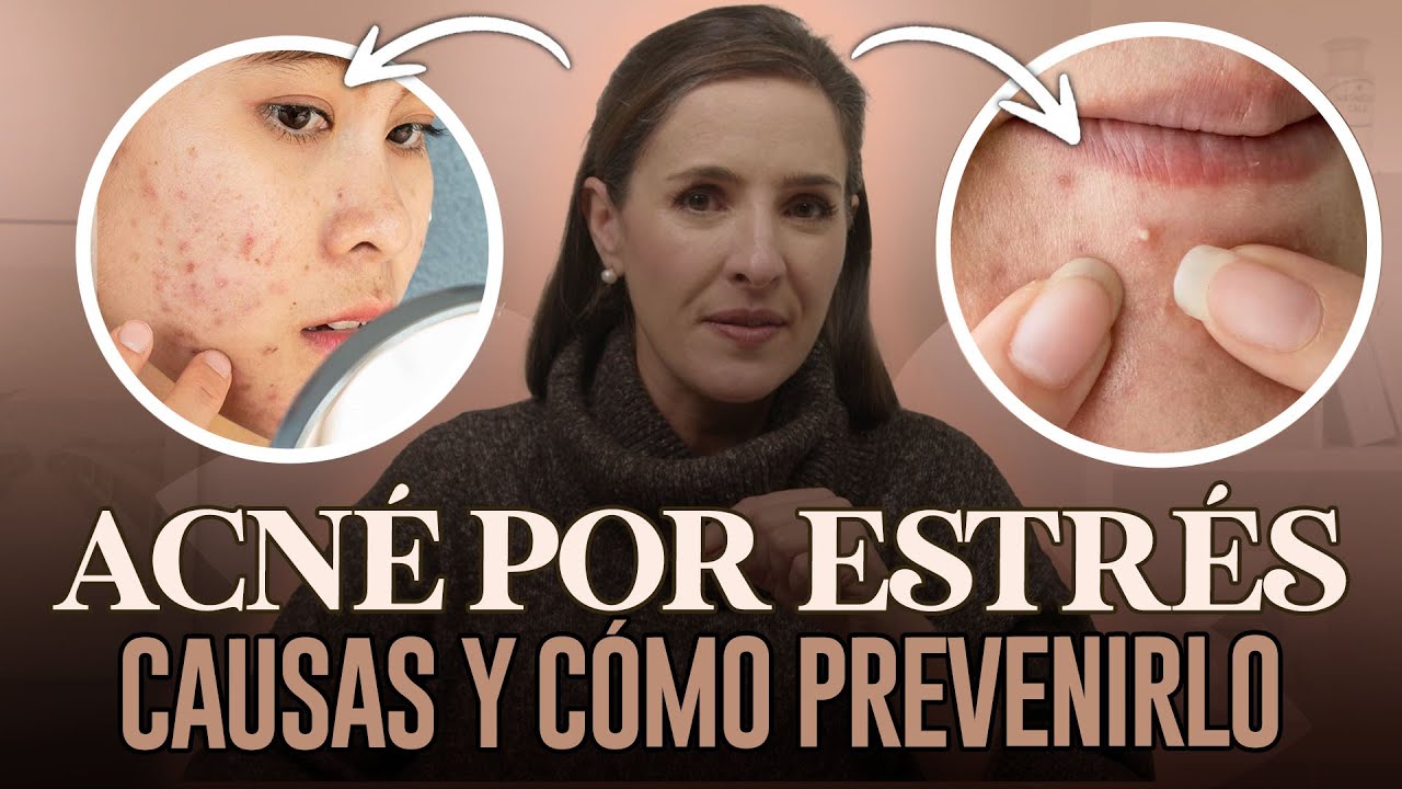 sarpullido en la cara por estres