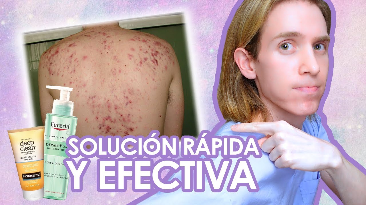 tipos de granos en la espalda