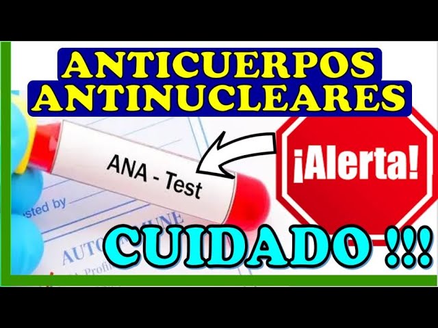 ana positivo 1 160 que significa