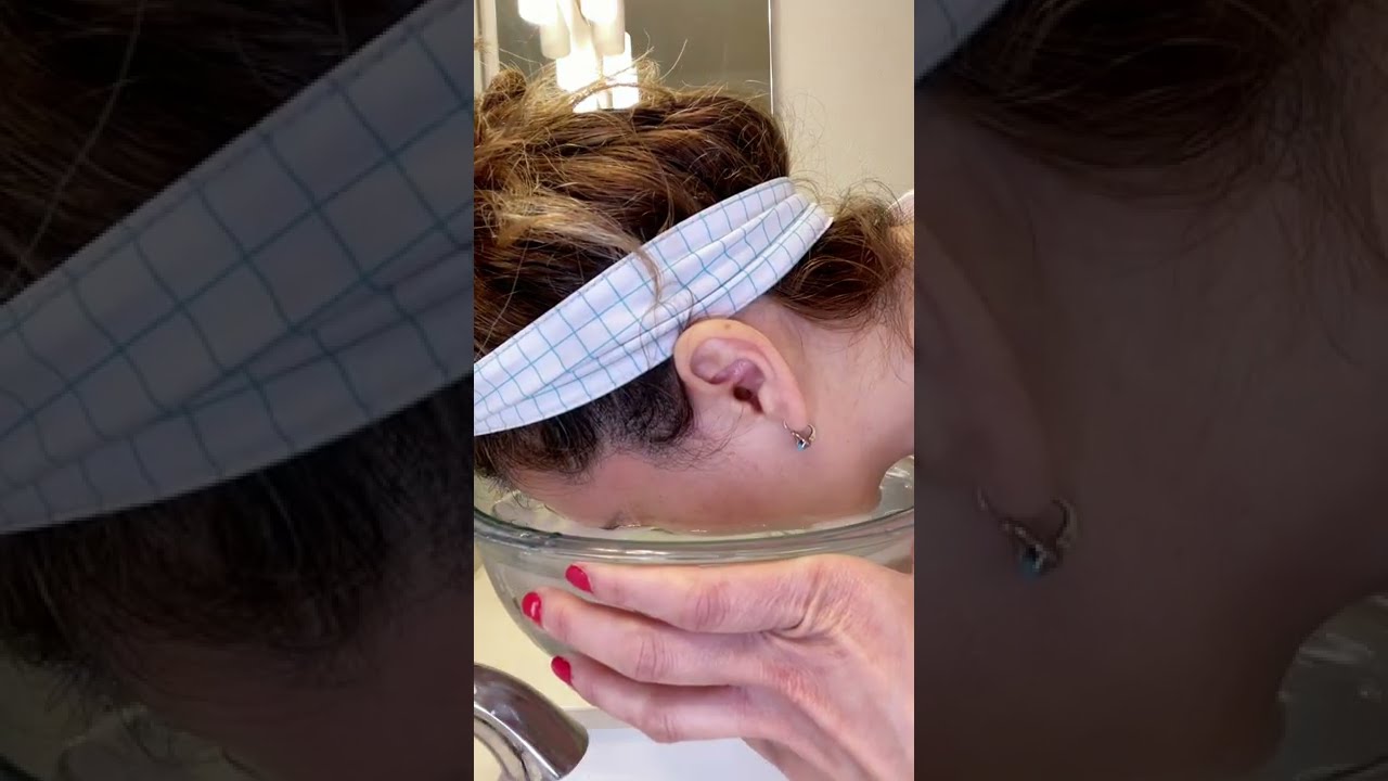 cara hinchada de un solo lado sin dolor