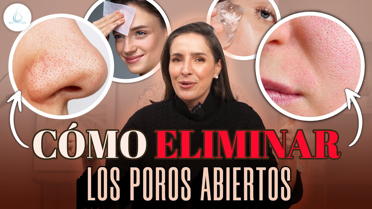 como cerrar los poros de la cara naturalmente