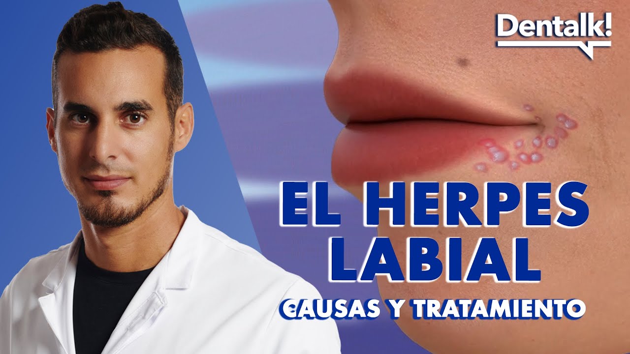 como quitar una calentura en el labio