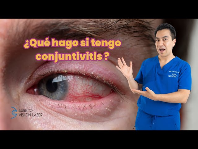 gotas para conjuntivitis sin receta médica