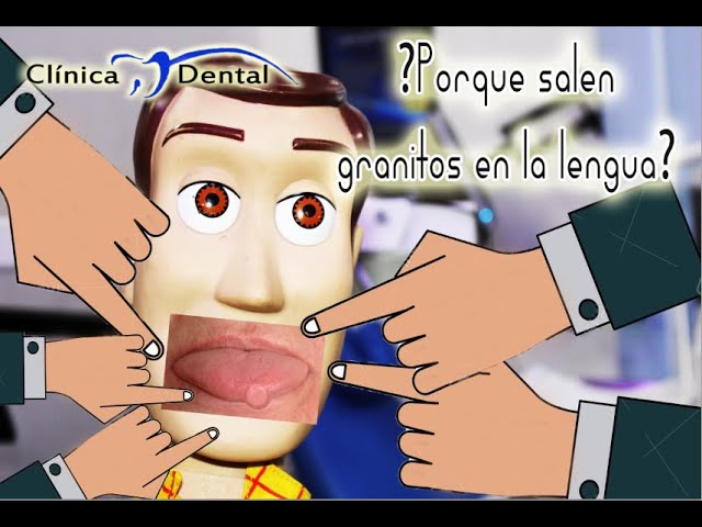 grano al final de la lengua