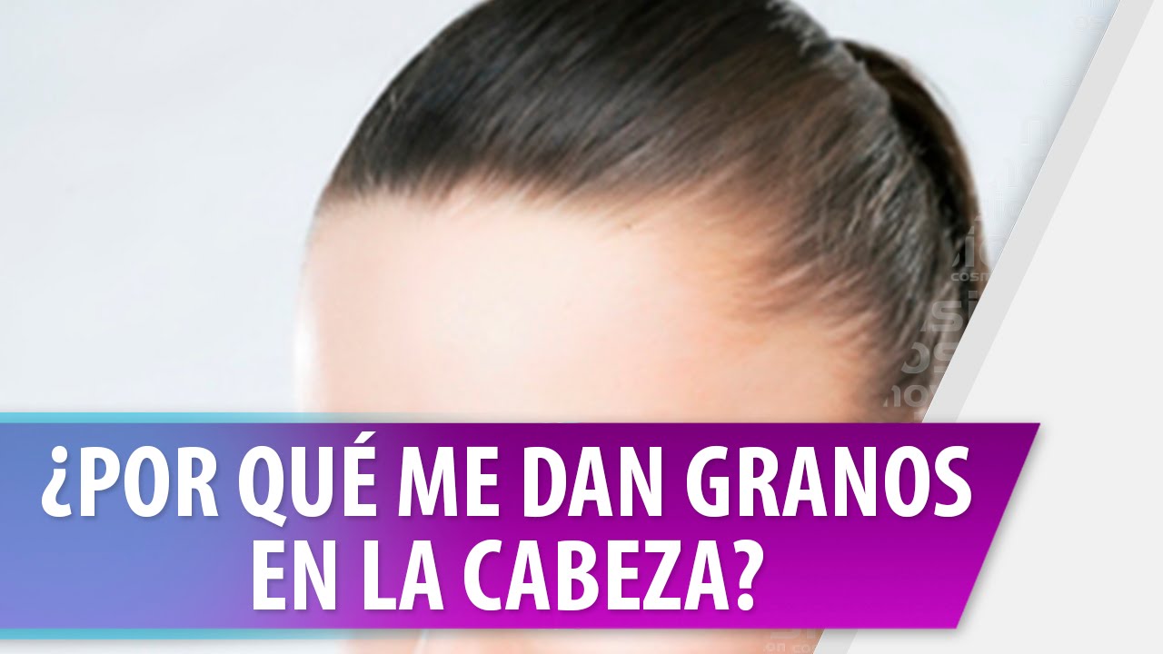 pq me salen granos en la cabeza