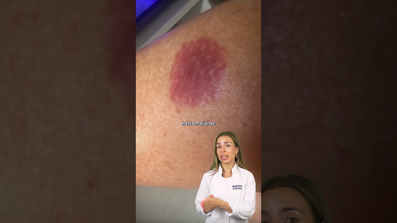 pq salen manchas rojas en la piel