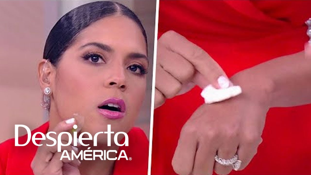 remedios caseros para eliminar manchas oscuras en la piel