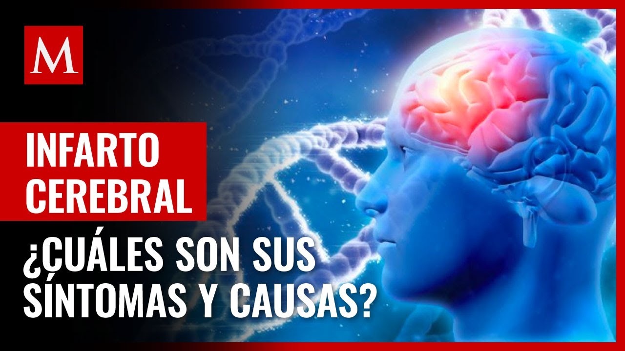 síntomas de derrame cerebral por estrés