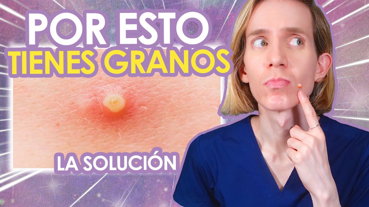 tipos de granos en el cuello