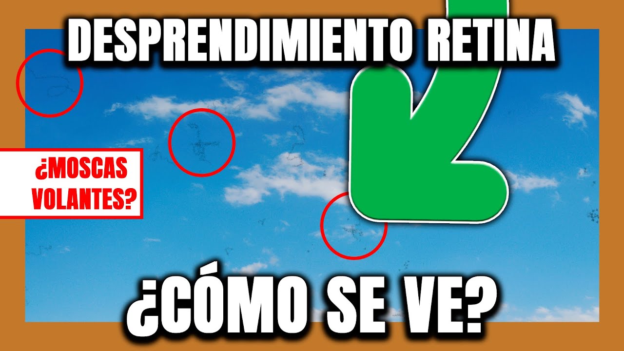 veo como ondas de agua en los ojos