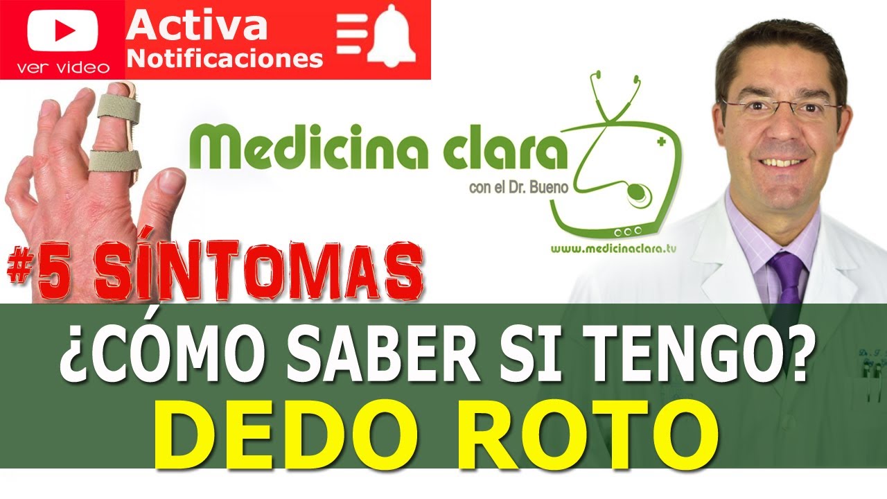 como saber si tengo el dedo roto de la mano