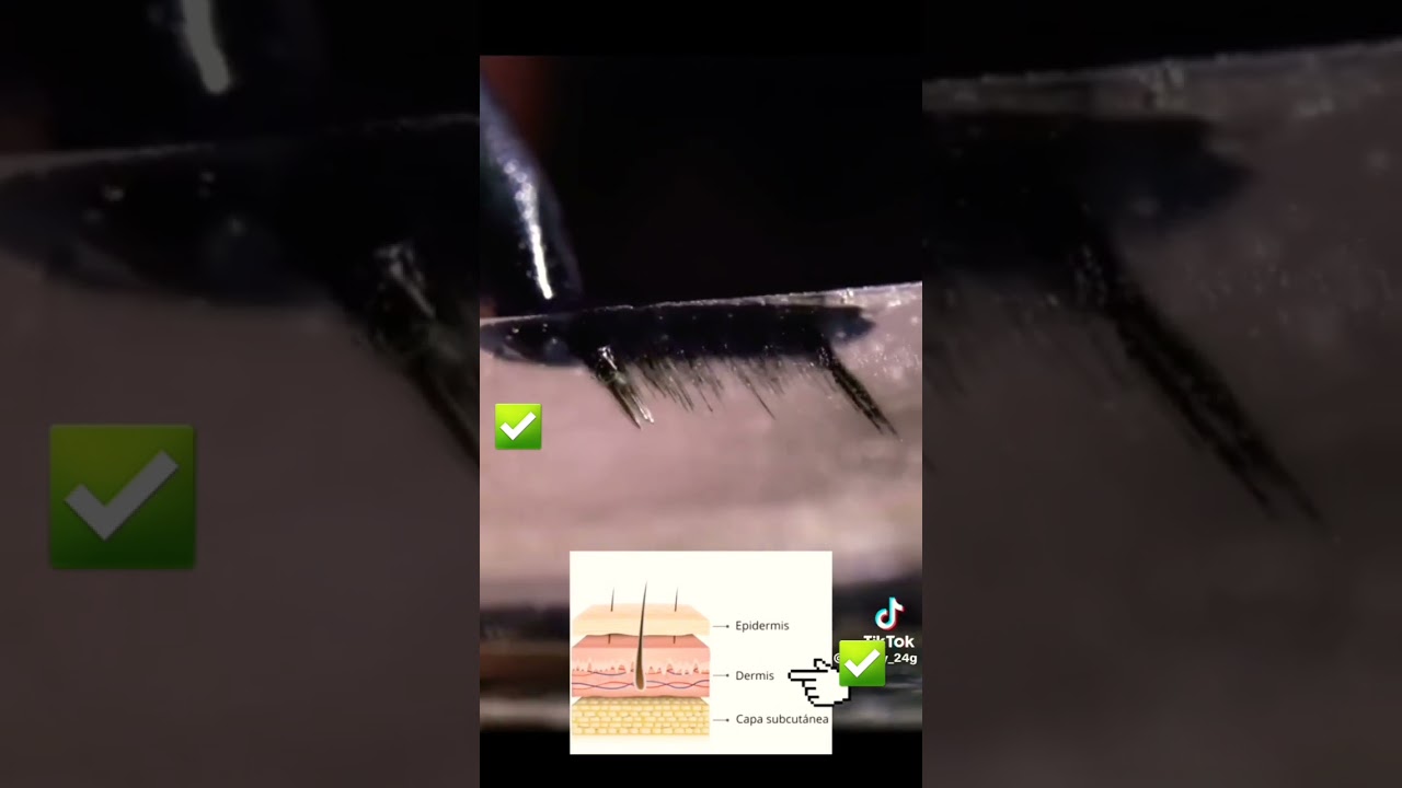 donde se inyecta la tinta del tatuaje