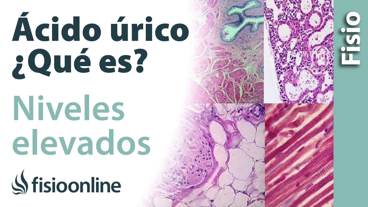 es malo tener ácido úrico bajo