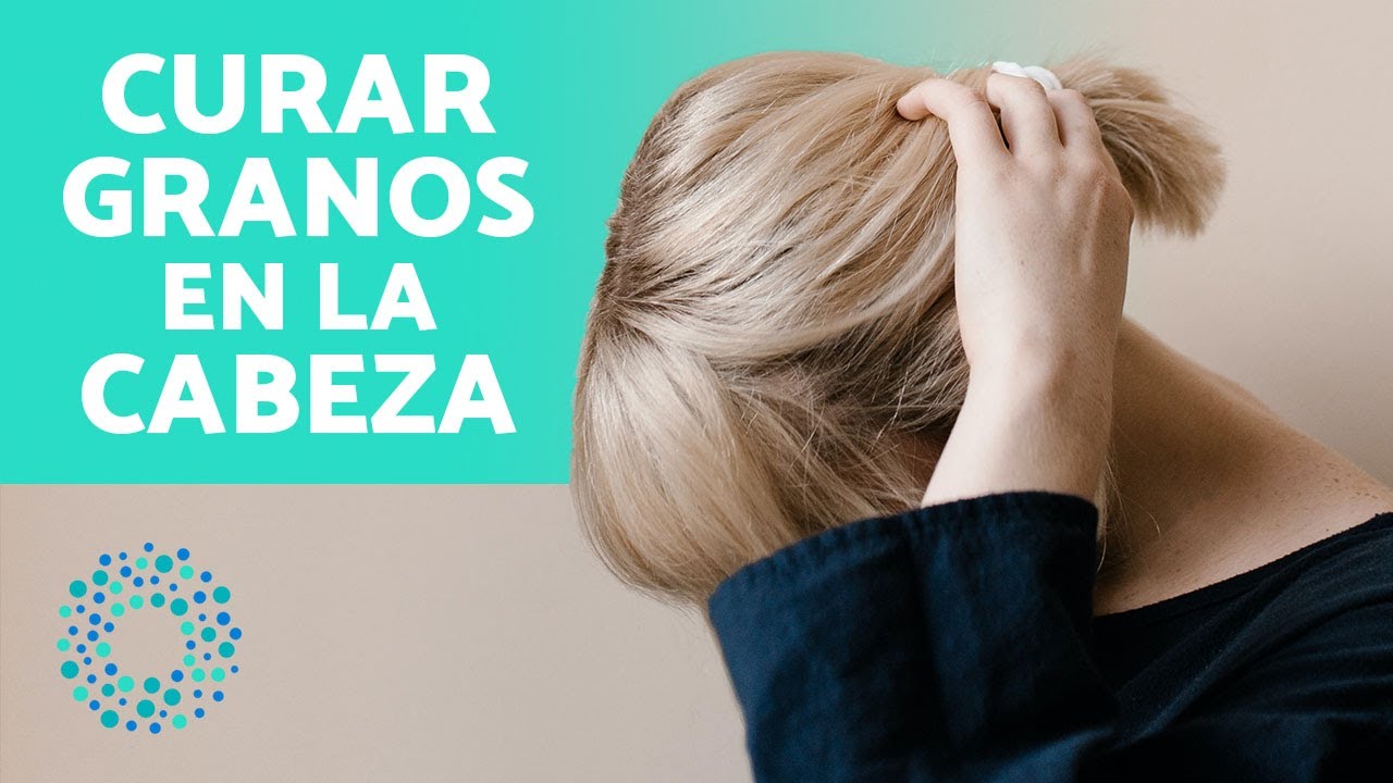 granos en la cabeza por estrés