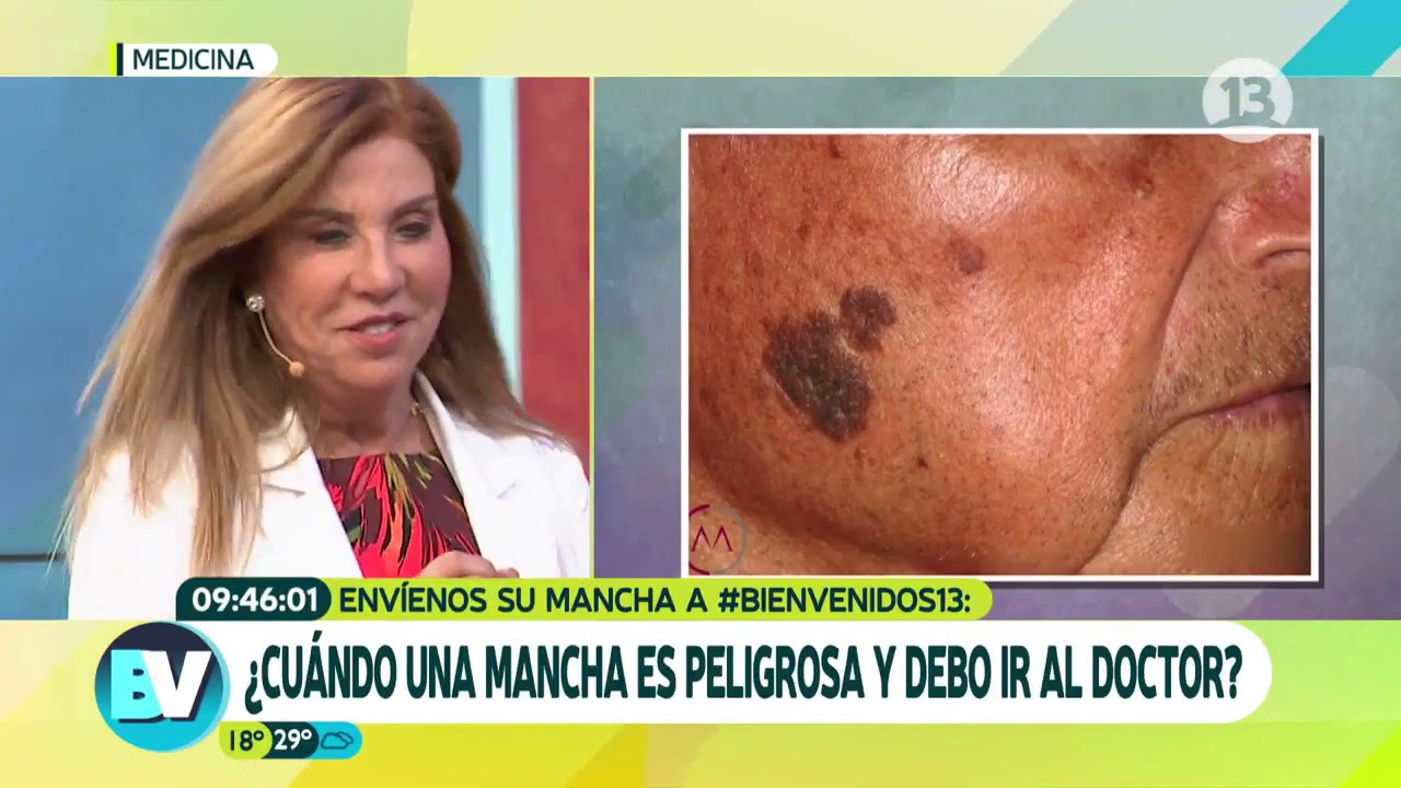 manchas marrones en la piel con relieve