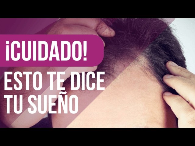 que significa soñar que te quedas calvo