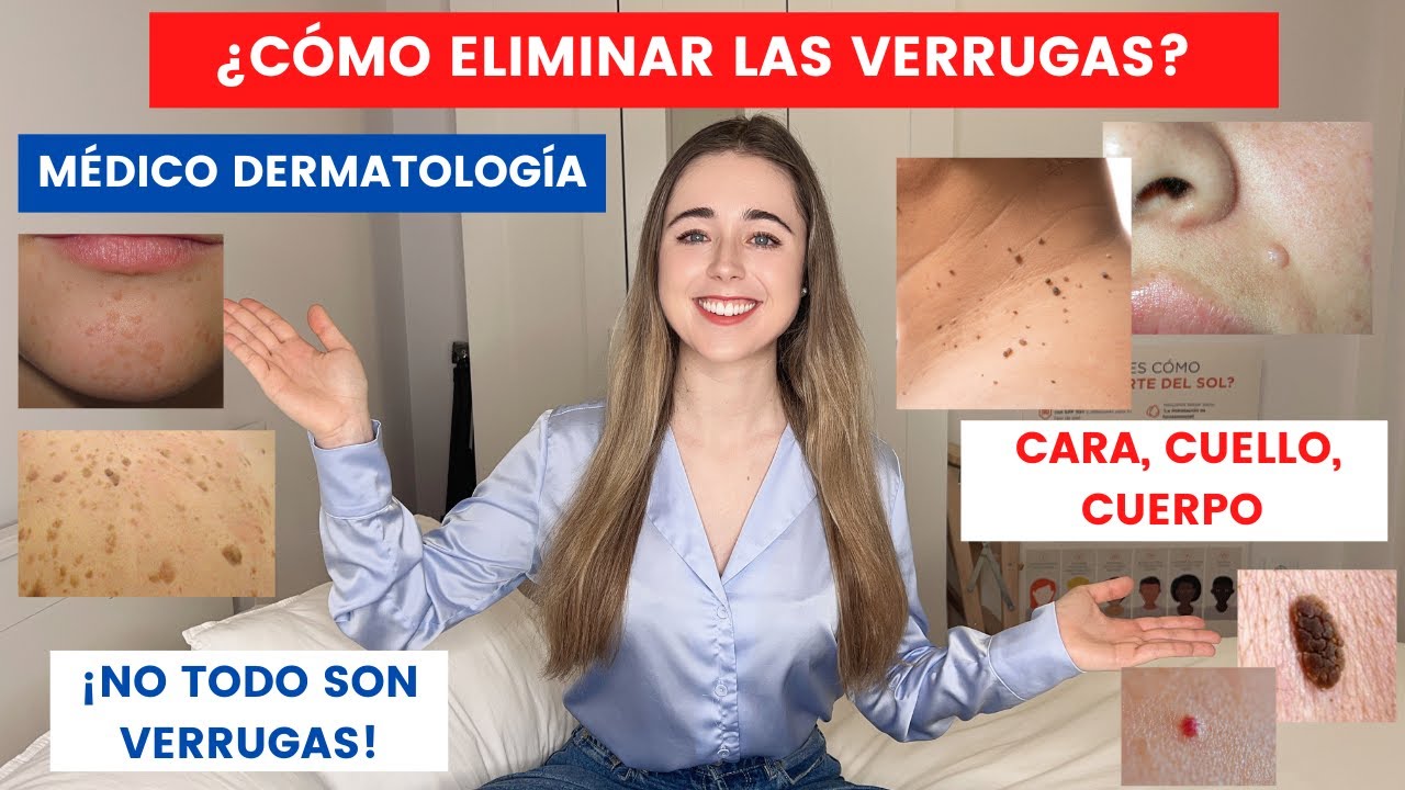 tipos de verruga en la cara