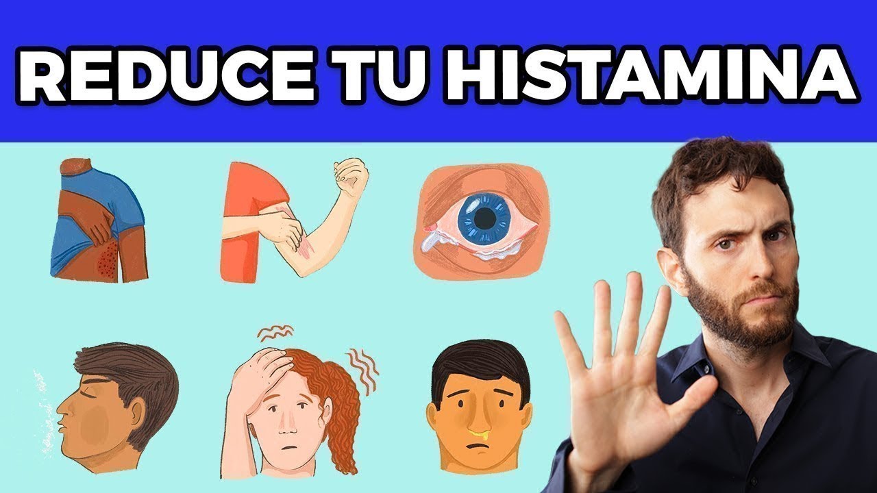 como bajar la histamina con remedios caseros
