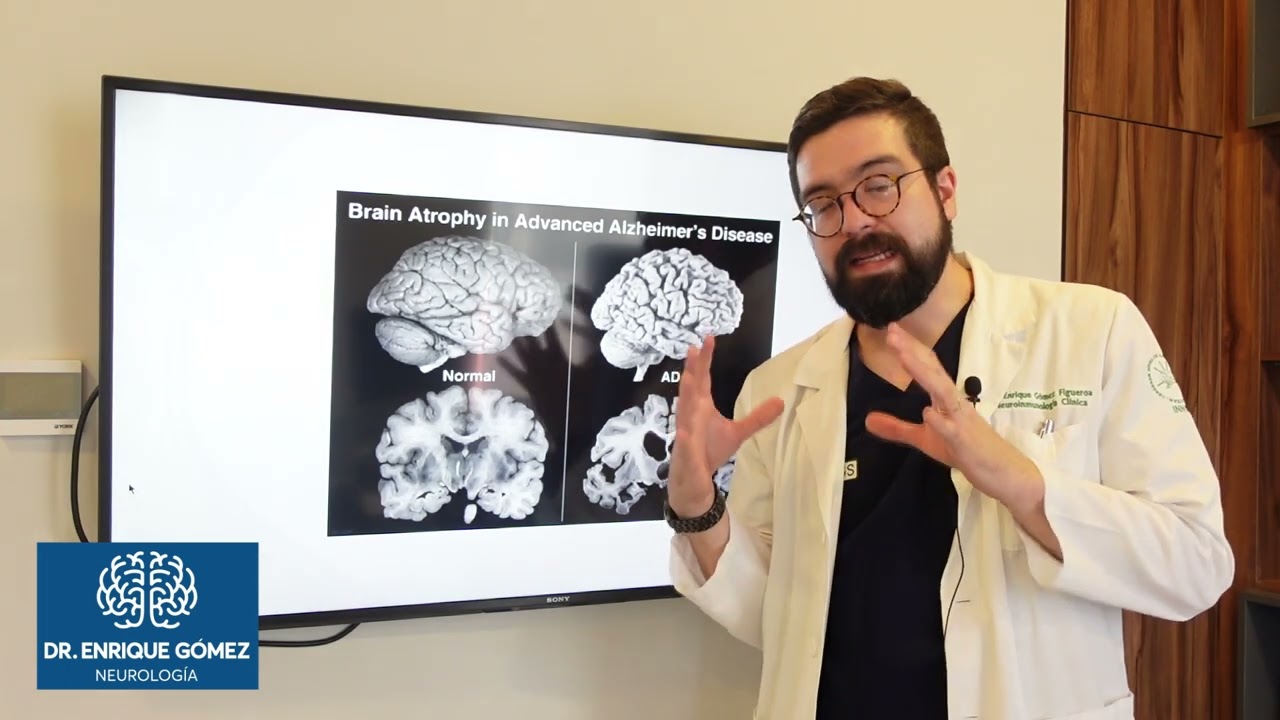 es grave la atrofia cortico subcortical