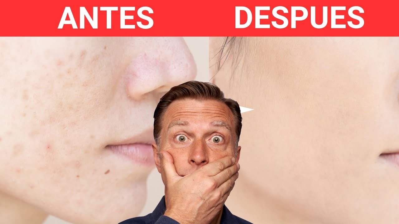 mejores probióticos para el sistema inmunológico