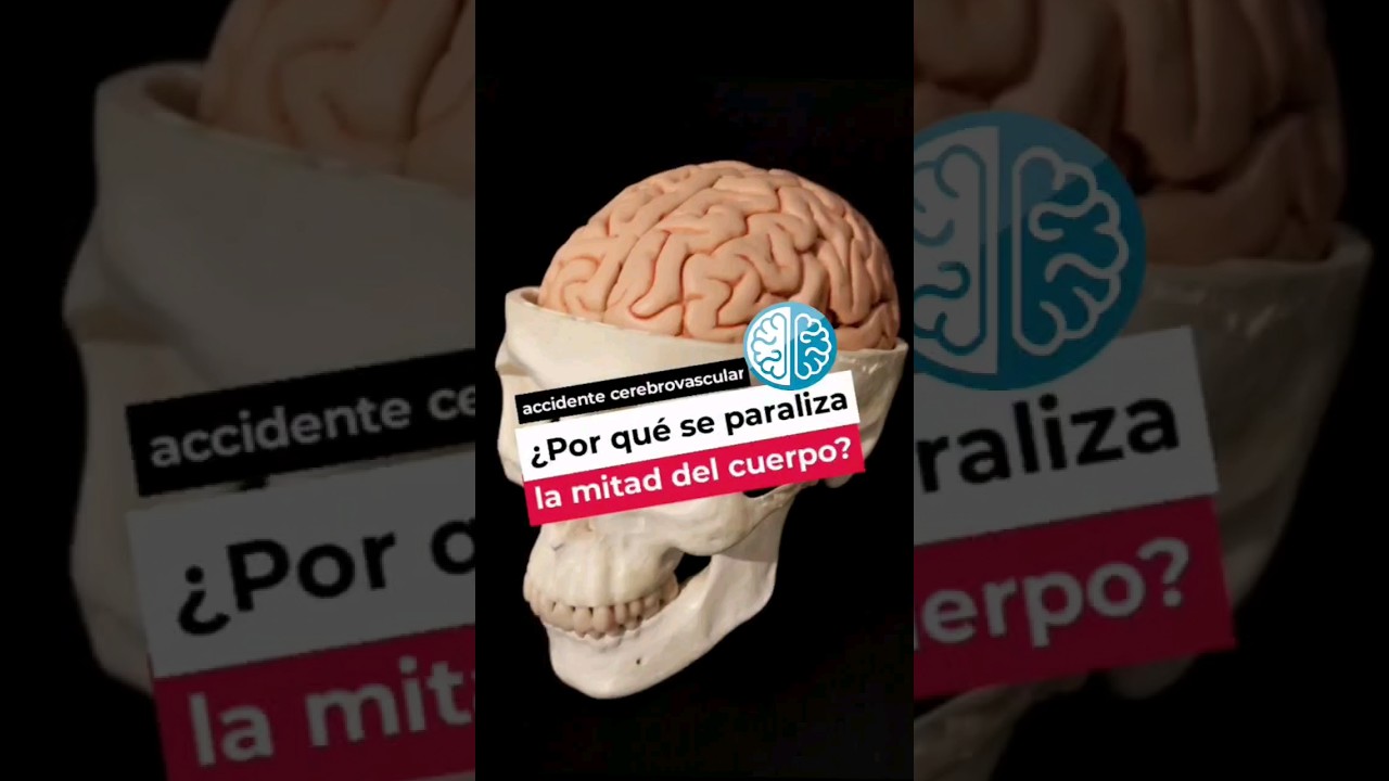 paralisis de la mitad del cuerpo