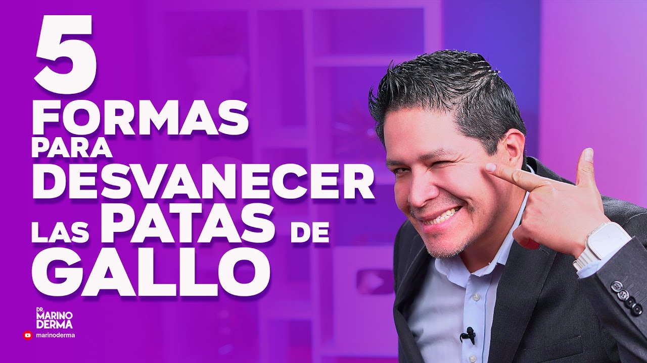 que son las patas de gallo