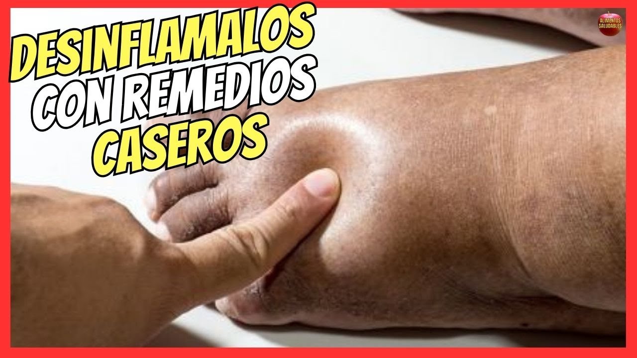 remedios caseros para bajar la inflamacion