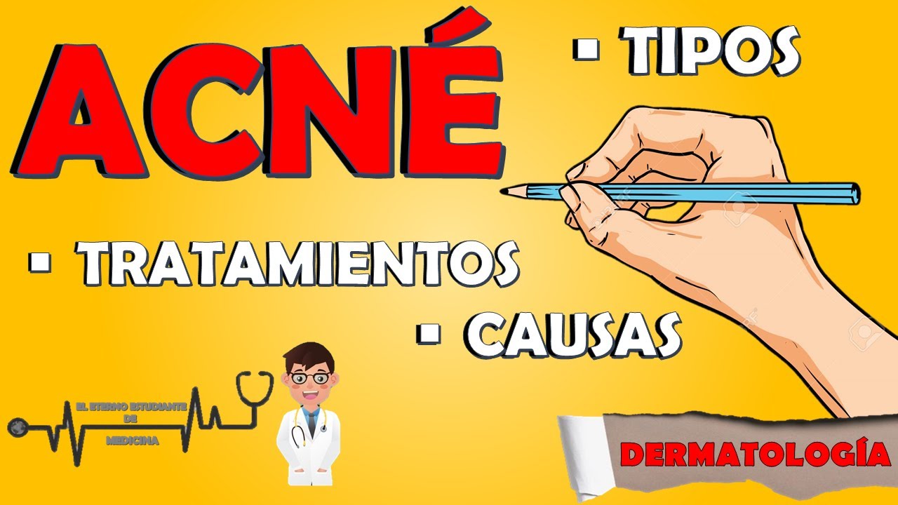 tipos de acne segun la zona