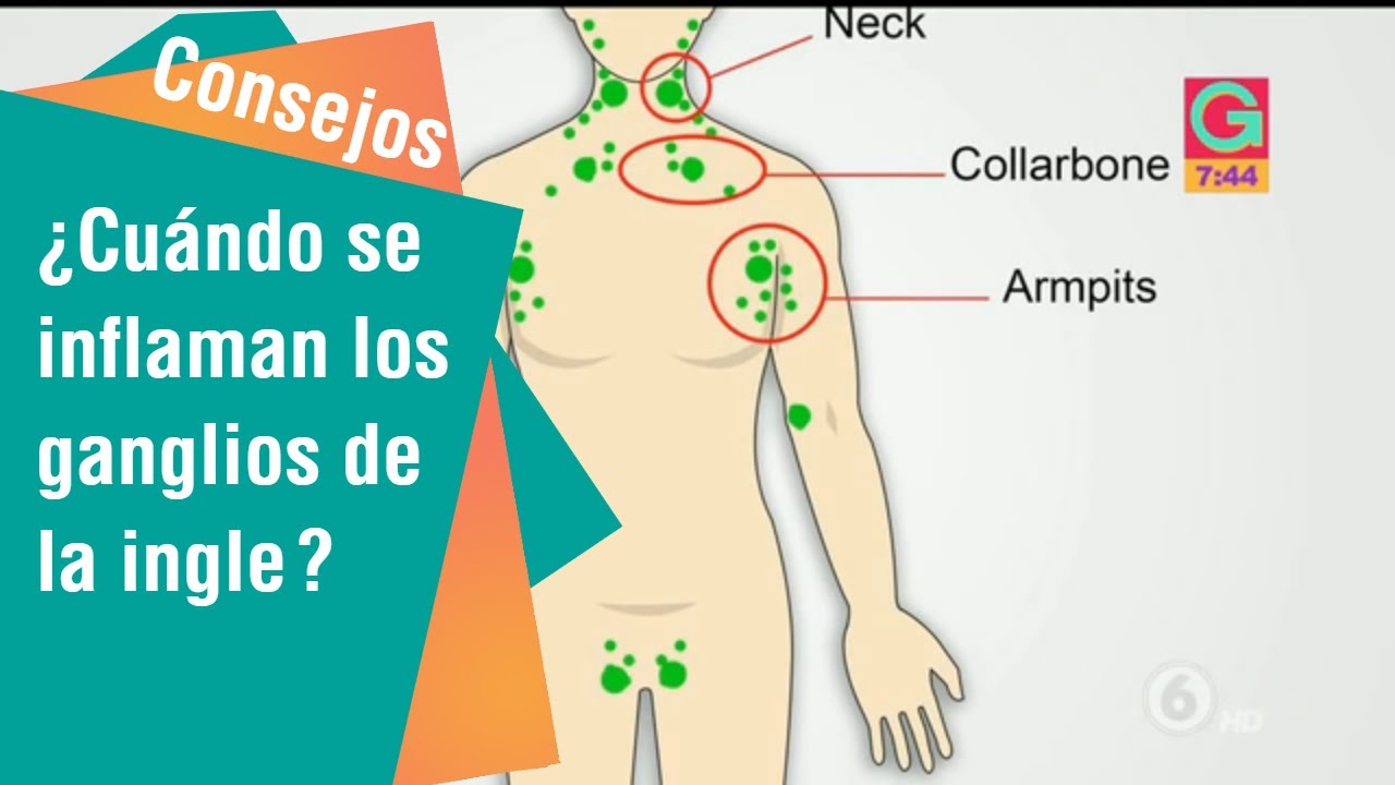 bulto en la ingle por dentro