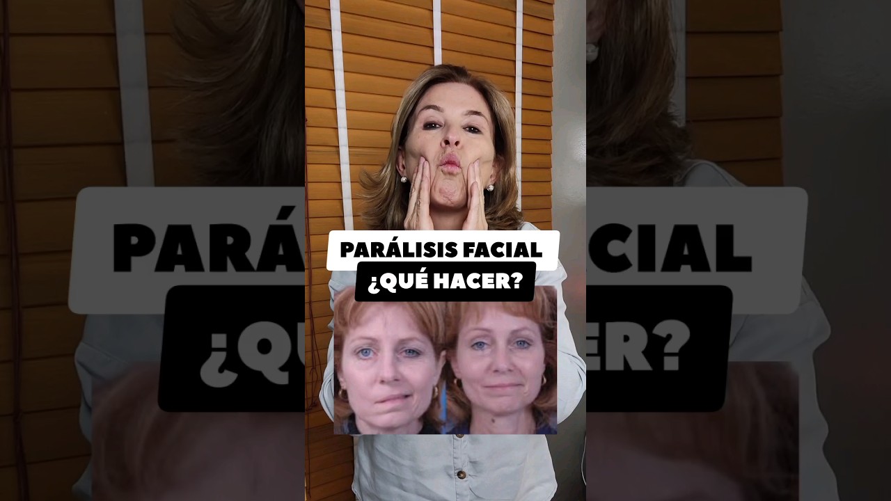 como aliviar el adormecimiento de la cara