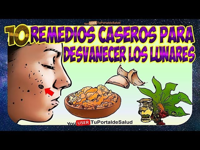 como quitar un lunar en casa