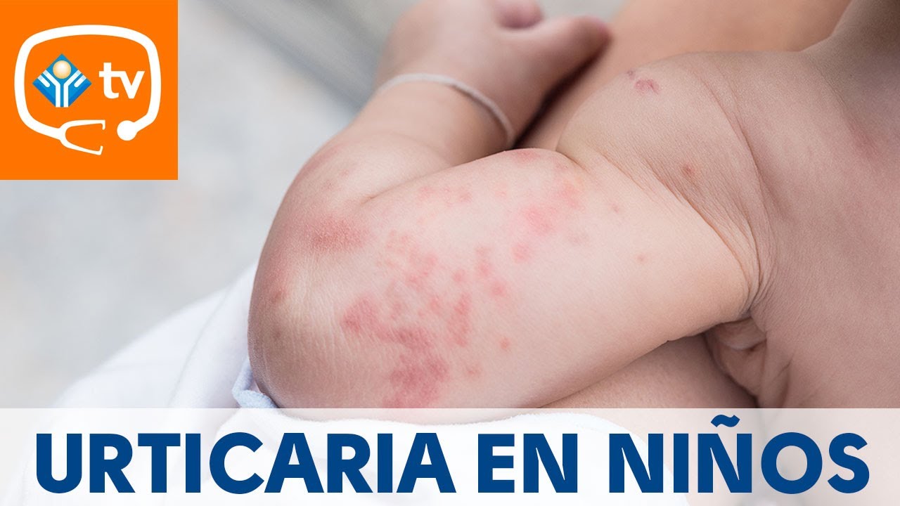 manchas rojas en la piel niños