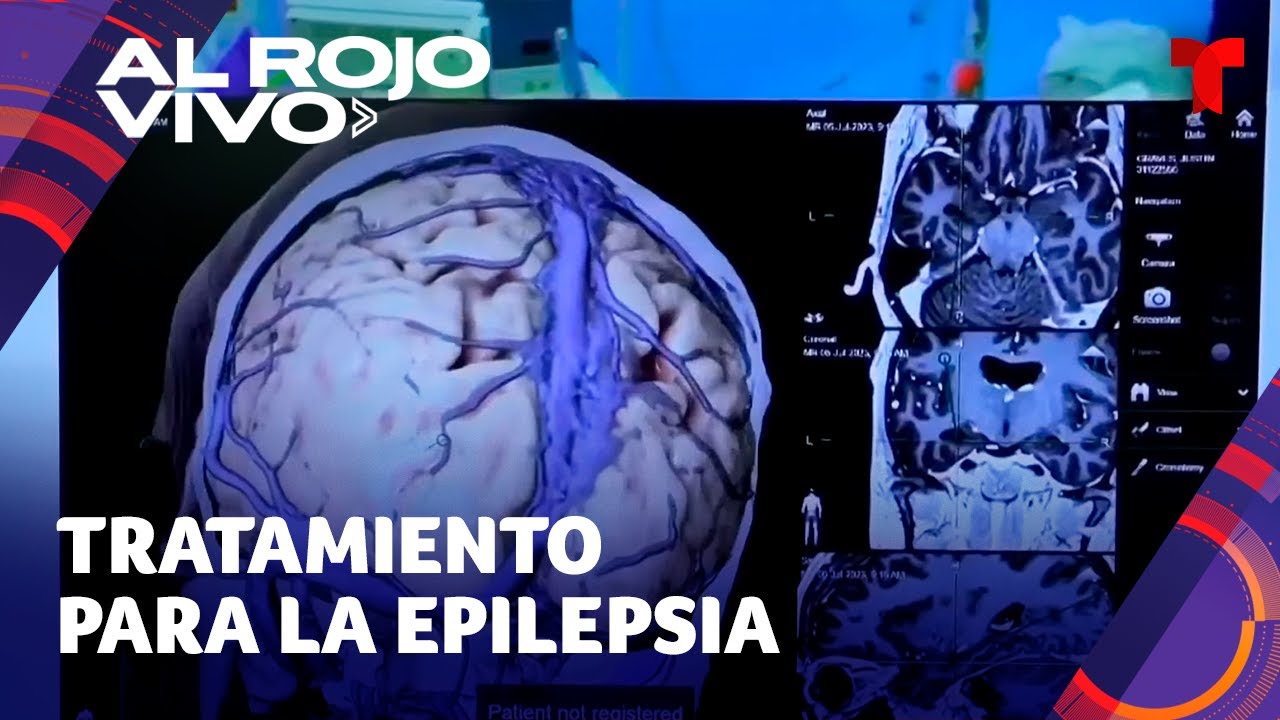 ultimos avances en la cura de la epilepsia